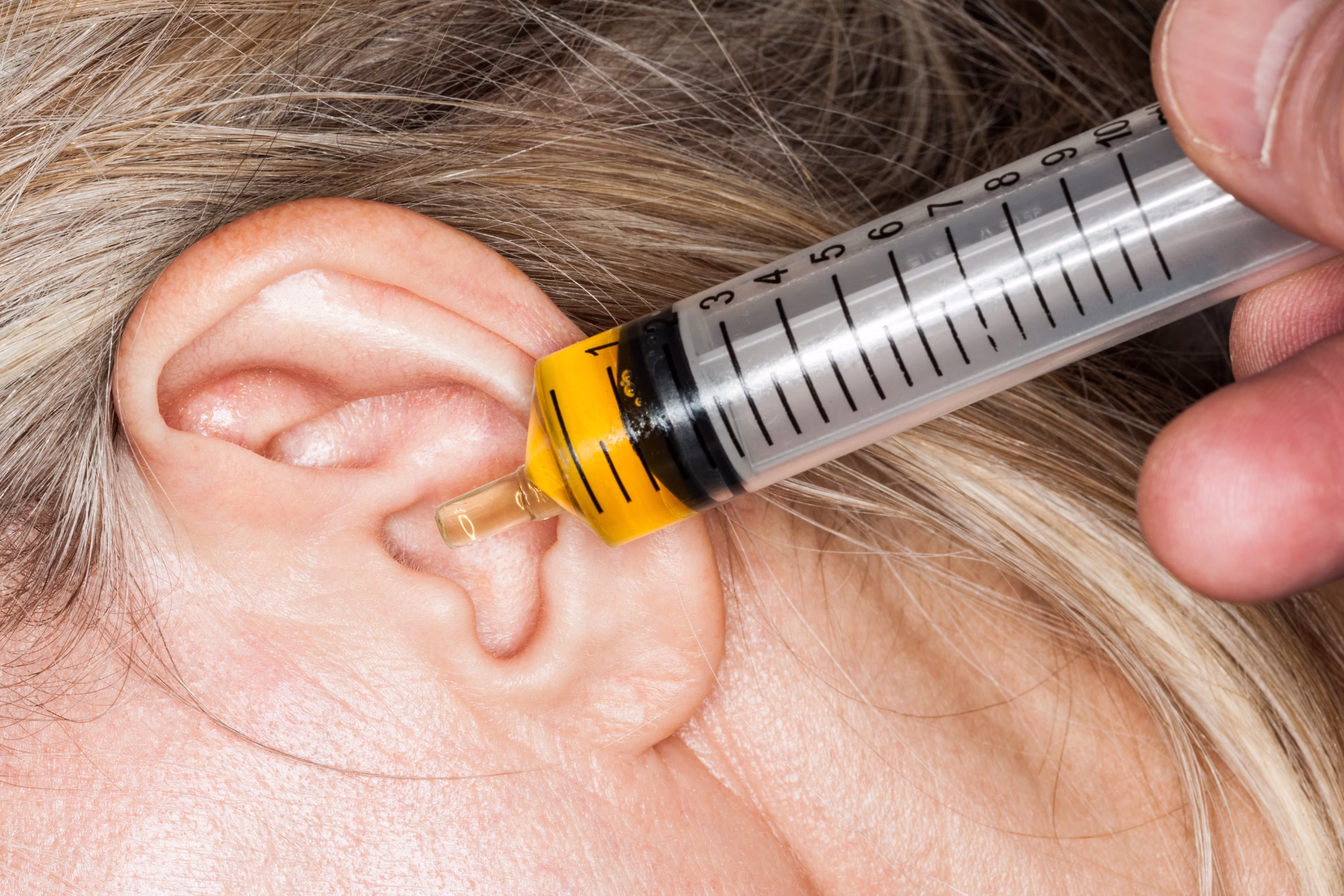 Drip some oil into your ear canal Putting olive oil into ear canal