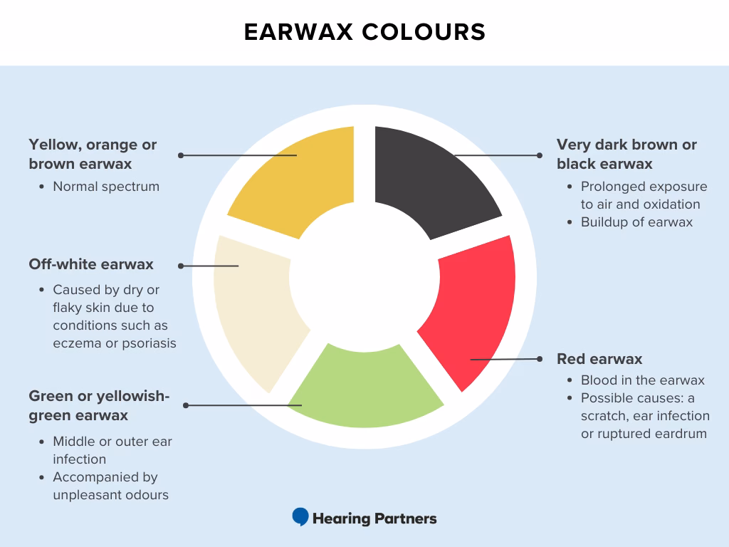 Infografik warna tahi telinga Infografik warna tahi telinga