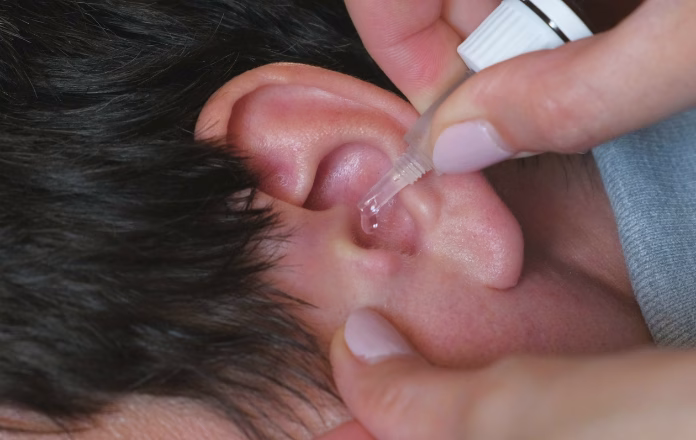 Applying Over-the-counter ear drops
