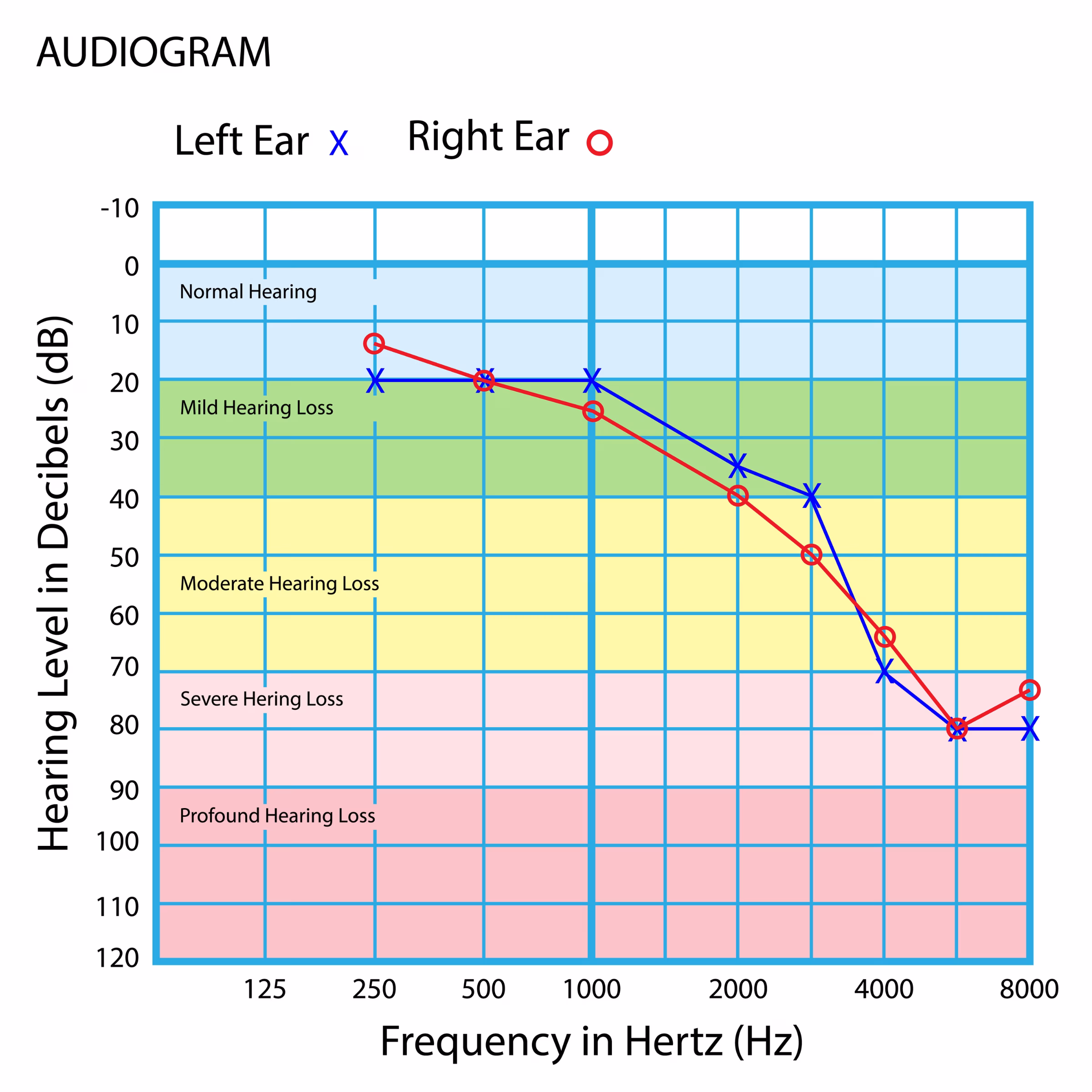Audiogram result