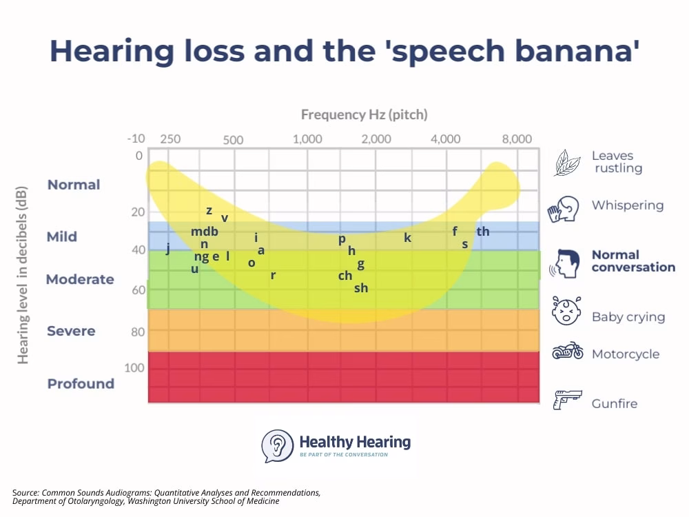 What an Audiogram Measures